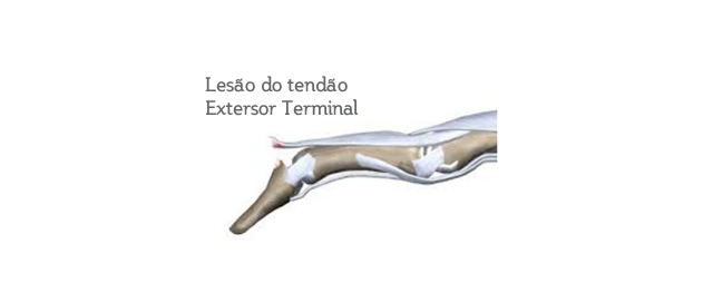 Ombro e Cotovelo - Traumacore - Centro de Traumatologia e Ortopedia